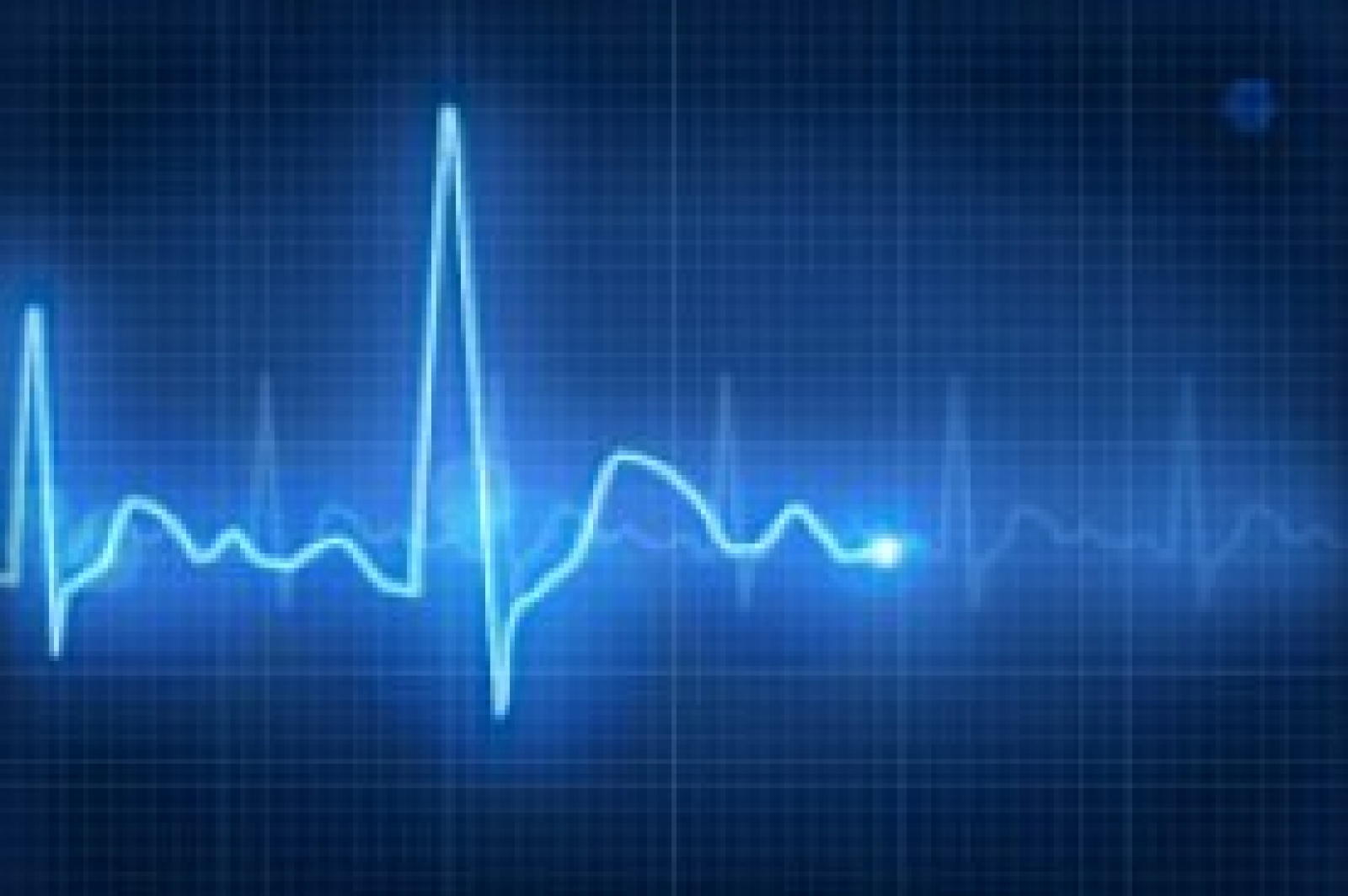 Elektrokardiyografi (EKG)