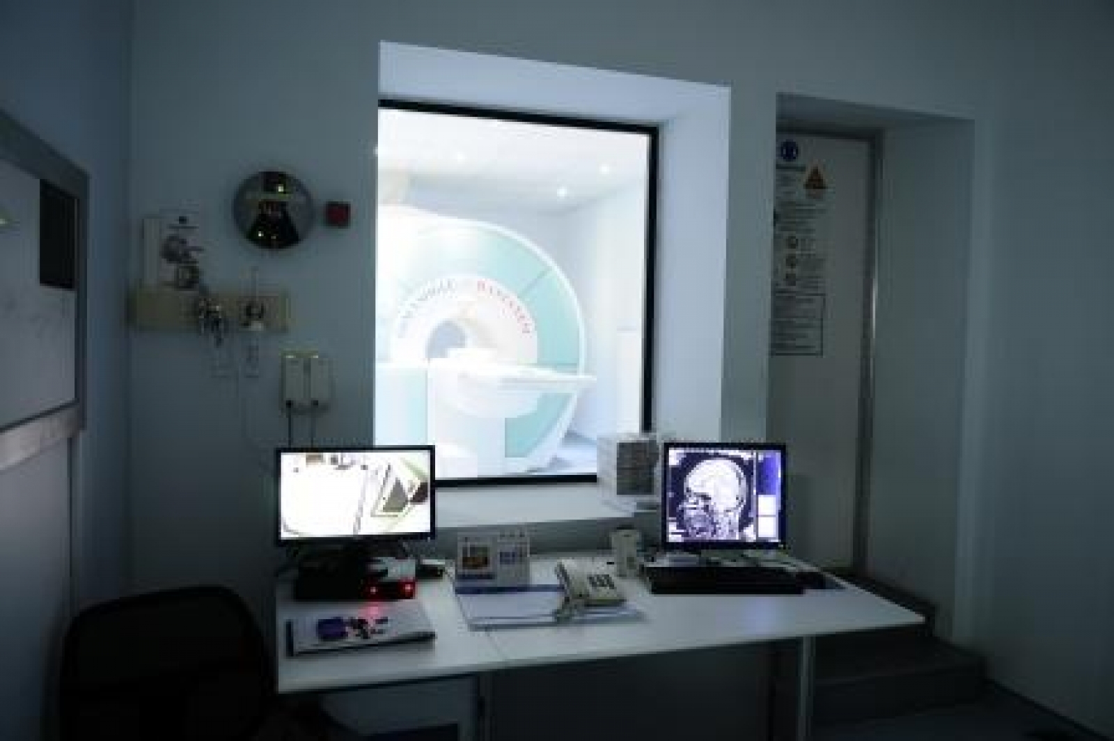 Manyetik Rezonans - (MRI)