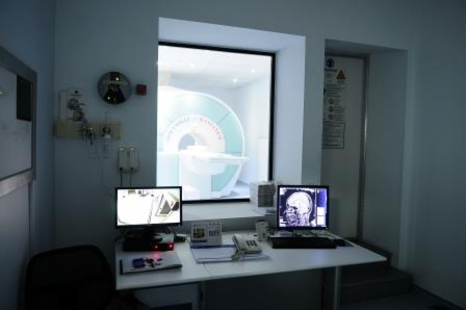 Magnetic Resonance Imaging (MRI)