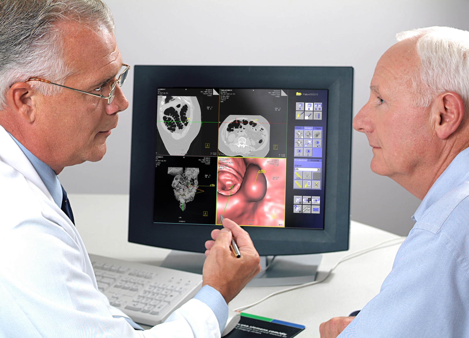 Rectosigmoidoscopy