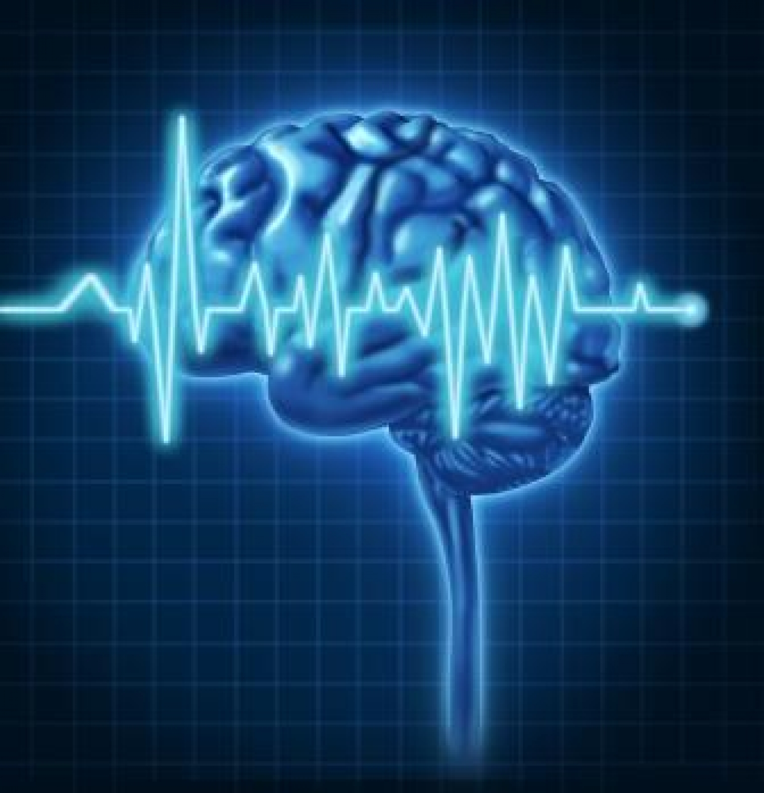 Electroencephalography (EEG)