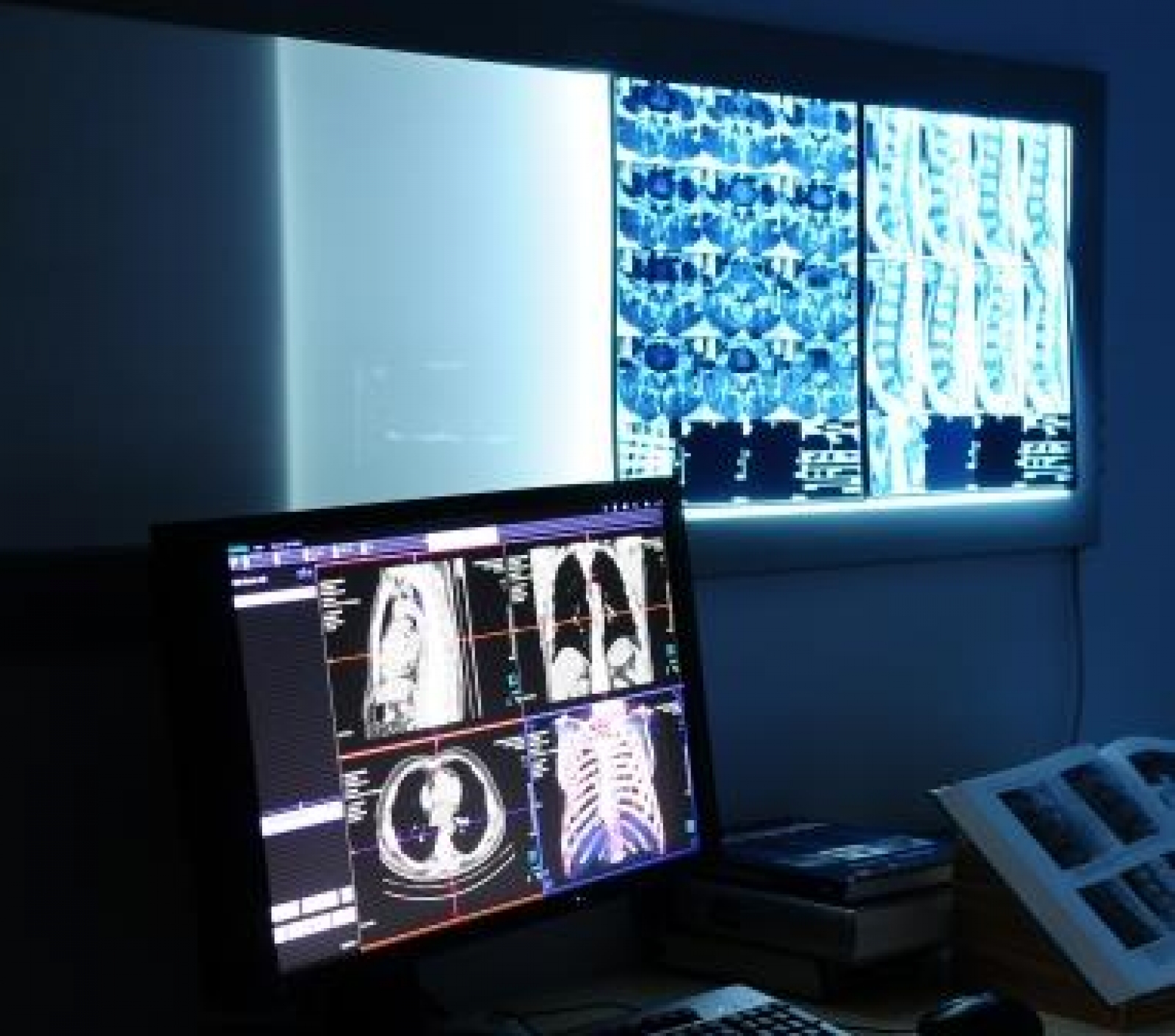 Interventional Radiology