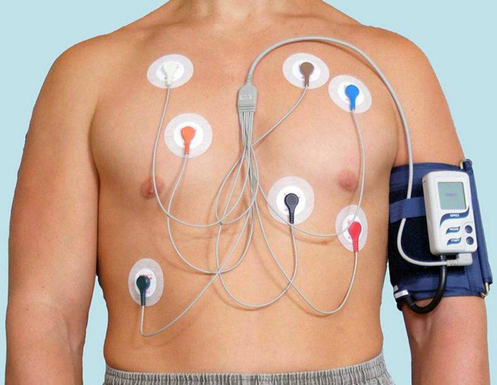 Holter Elektrokardiyografi (Holter EKG)