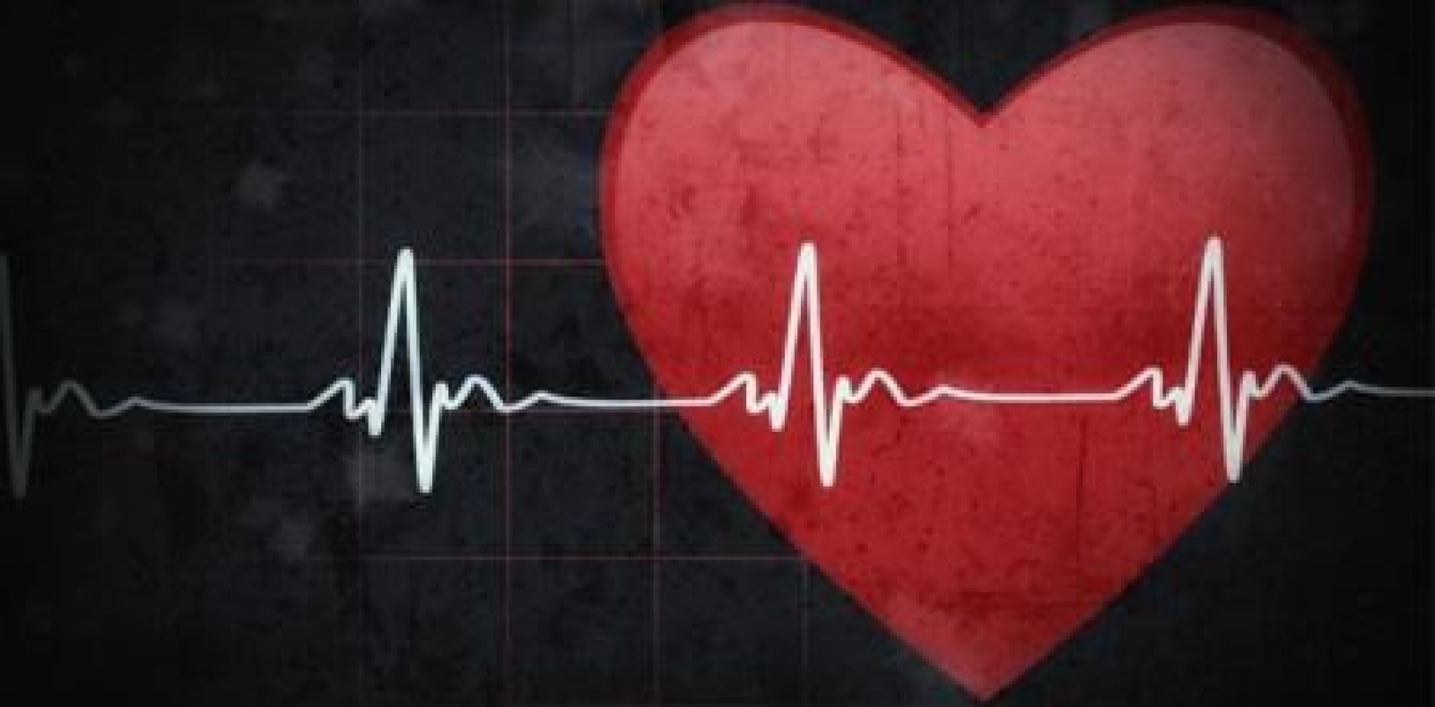 Holter Elektrokardiyografi (Holter EKG)