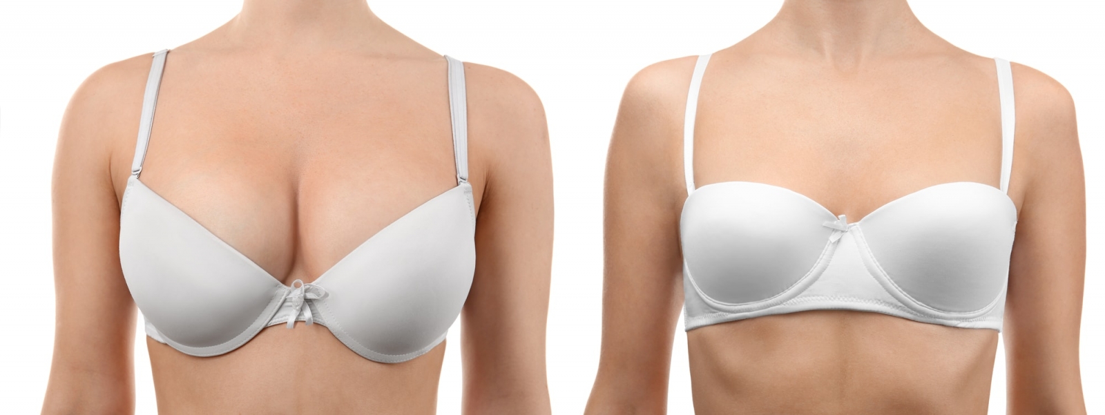 Breast Aesthetic Surgeries